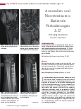 Vorschauseite 1: Anomalien und Normvarianten: Skelettale Veränderungen 3.27 Ulna-Längenvarianten