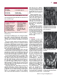 Vorschauseite 2: Anomalien und Normvarianten: Skelettale Veränderungen 3.27 Ulna-Längenvarianten