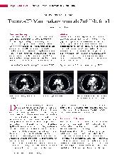 Vorschauseite 1: Thorax-CT: Mammakarzinom als Zufallsbefund