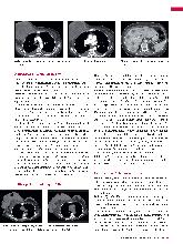 Vorschauseite 2: Thorax-CT: Mammakarzinom als Zufallsbefund