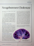 Vorschauseite 2: Alagille und die Neugeborenen-Cholestase