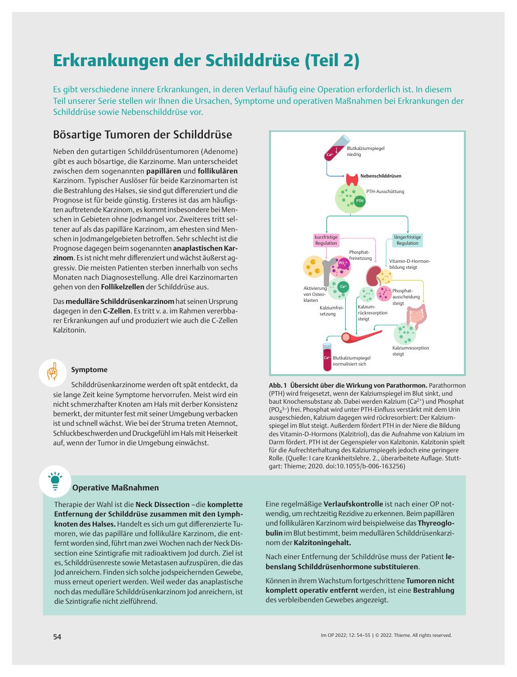 Vorschauseite 1: Erkrankungen der Schilddrüse (Teil 2)