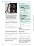 Vorschauseite 2: Der Perikardersatz bei infizierter Aortenprothese