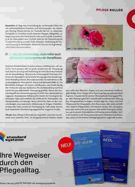 Vorschauseite 2: Peristomale Wunden - Ursachen und Behandlung