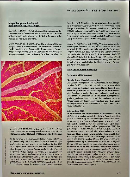 Vorschauseite 2: Netzhauterkrankungen