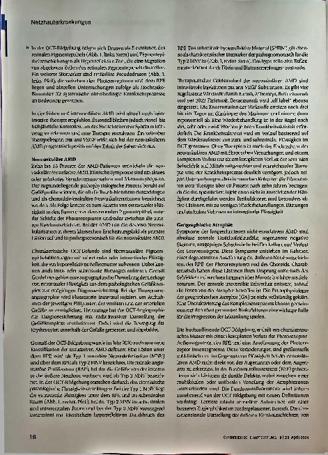Vorschauseite 3: Netzhauterkrankungen