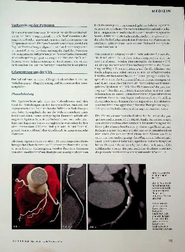 Vorschauseite 2: Koronar-CT zur Abklärung des chronischen Koronarsyndroms