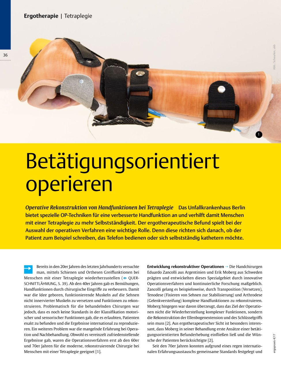 Vorschauseite 1: Operative Rekonstruktion von Handfunktionen bei Tetraplegie ? Betätigungsorientiert operieren