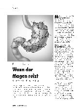 Vorschauseite 1: Funktionelle Dyspepsie: Wenn der Magen reizt.