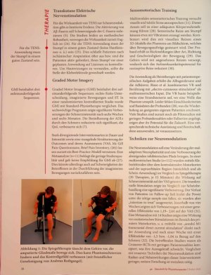 Vorschauseite 3: Unvergessener Verlust Therapieansätze bei Phantomschmerz