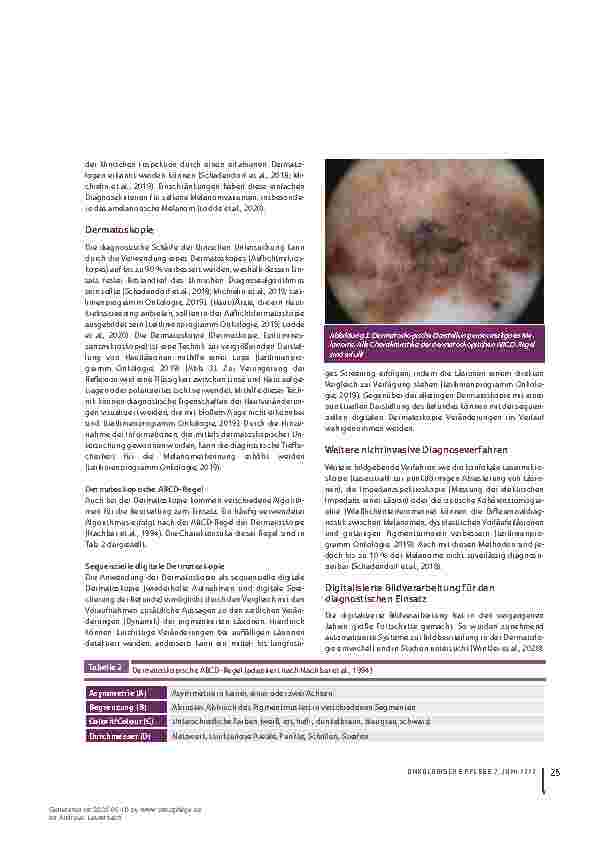 Vorschauseite 4: Klinische Diagnostik des malignen Melanoms