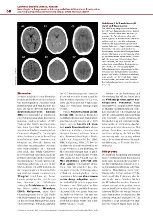 Vorschauseite 5: Neurologische Prognoseeinschätzung nach Herzstillstand und Reanimation: Update 2025