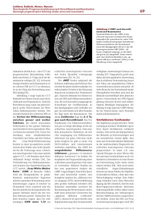 Vorschauseite 6: Neurologische Prognoseeinschätzung nach Herzstillstand und Reanimation: Update 2025