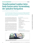 Vorschauseite 1: Transforaminal Lumbar Interbody Fusion unter Verwendung der spinalen Navigation