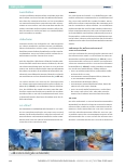 Vorschauseite 3: Transforaminal Lumbar Interbody Fusion unter Verwendung der spinalen Navigation