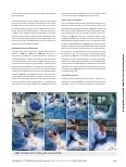 Vorschauseite 4: Transforaminal Lumbar Interbody Fusion unter Verwendung der spinalen Navigation