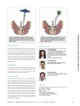 Vorschauseite 6: Transforaminal Lumbar Interbody Fusion unter Verwendung der spinalen Navigation