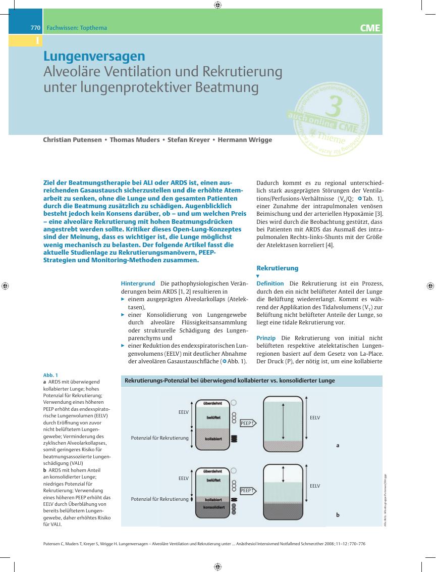 Vorschauseite 1: Alveoläre Ventilation und Rekrutierung unter lungenprotektiver Beatmung