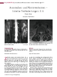 Vorschauseite 1: Anomalien und Normvarianten – Interne Veränderungen 2.11 Ureter fissus
