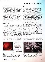 Vorschauseite 4: Erkrankungen des Mittelohrs