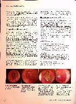 Vorschauseite 5: Erkrankungen des Mittelohrs