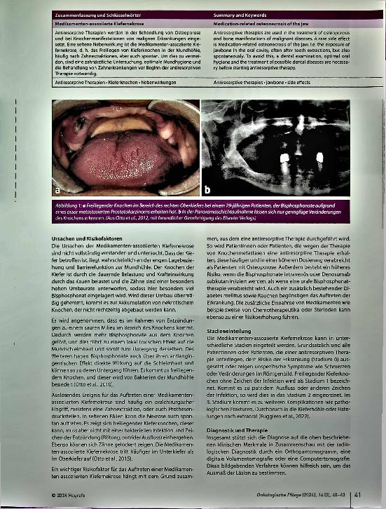 Vorschauseite 2: Medikamentenassoziierte Kiefernekrose