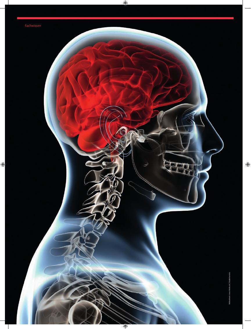 Vorschauseite 1: Entzündungen des ZNS – Meningitis, Enzephalitis und Co.