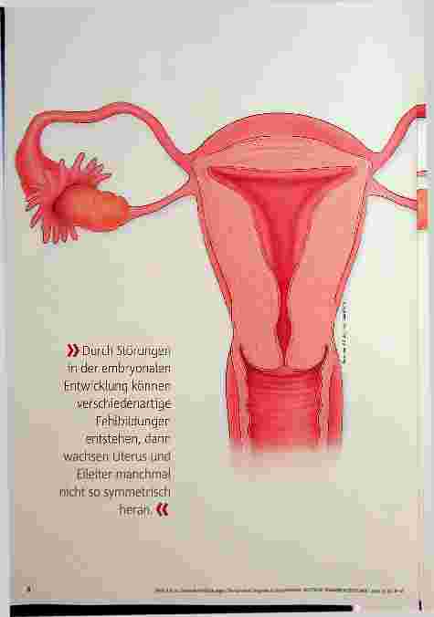 Vorschauseite 1: Genitale Fehlbildungen Die korrekte Diagnose ist entscheidend