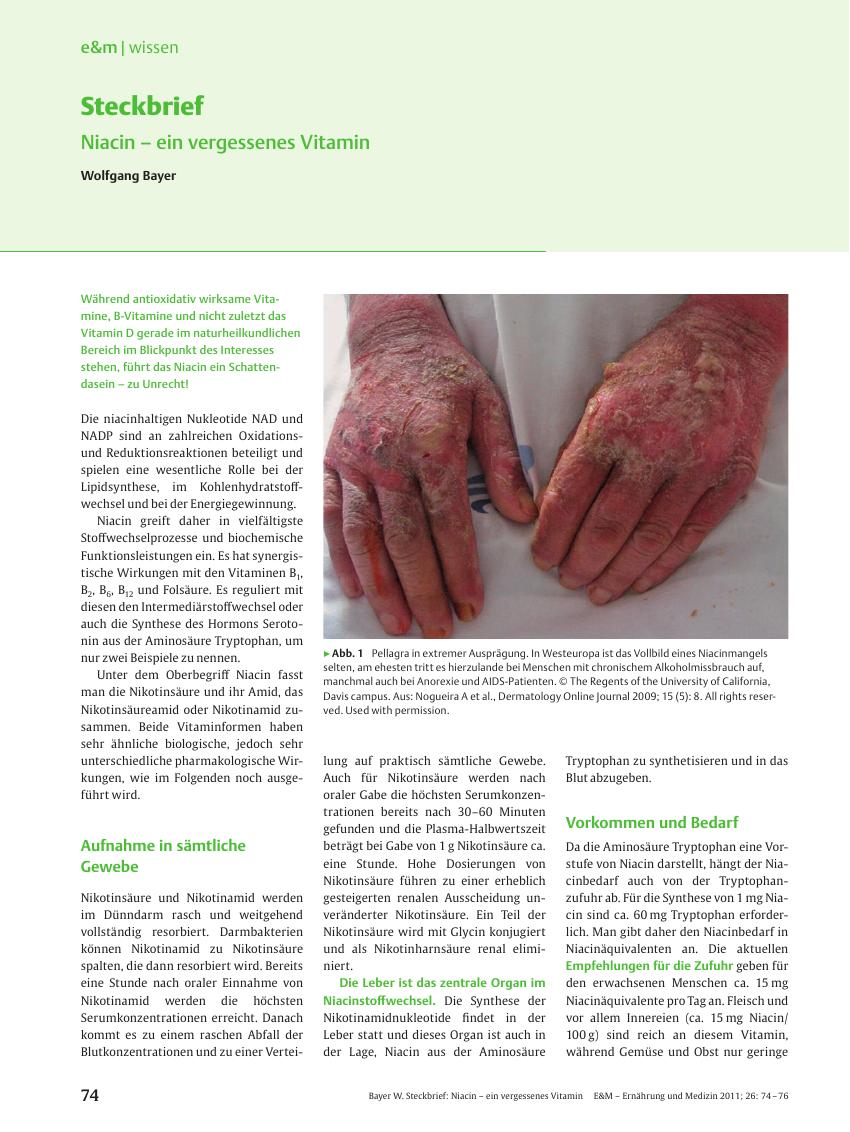 Vorschauseite 1: Steckbrief: Niacin – ein vergessenes Vitamin