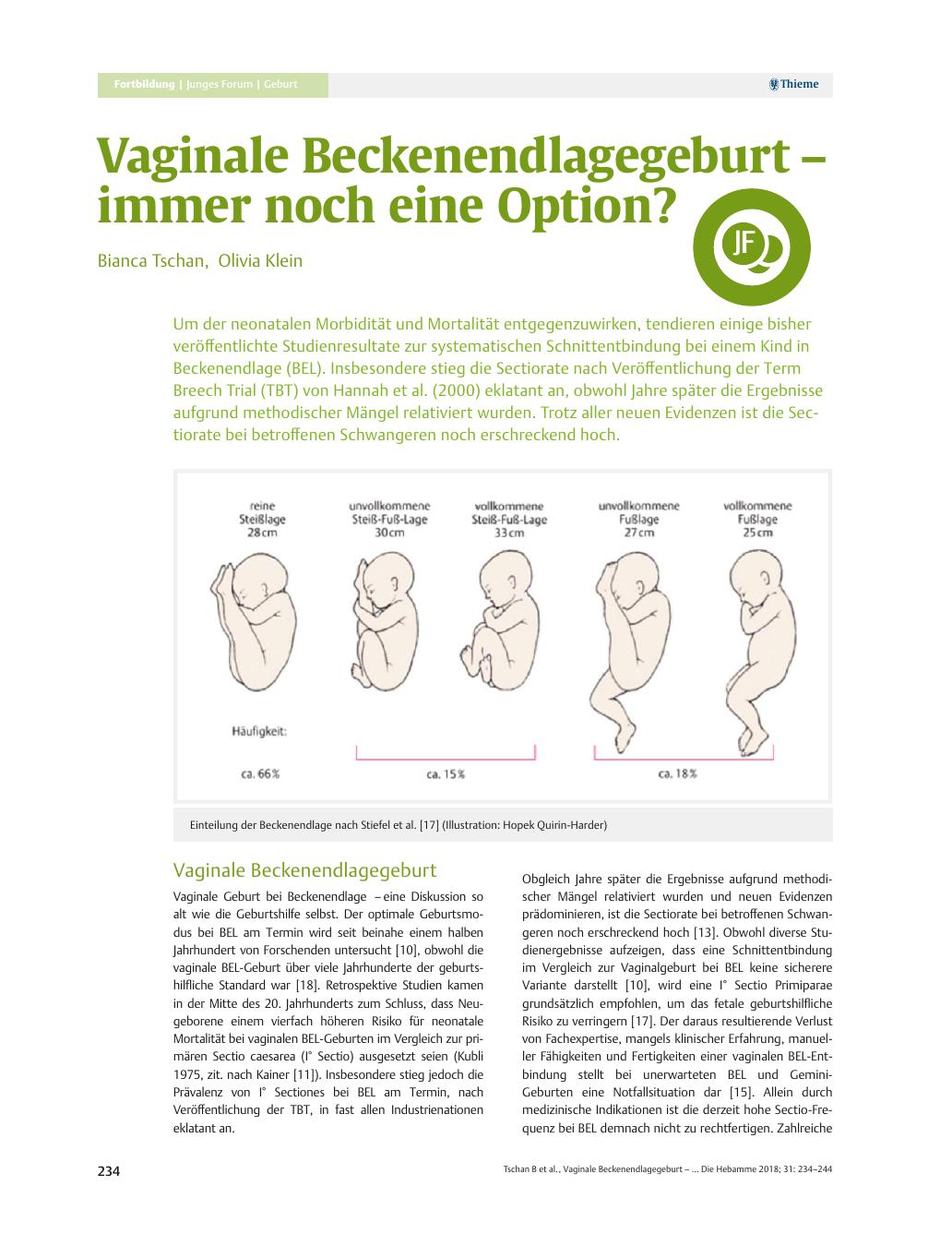 Vorschauseite 1: Vaginale Beckenendlagegeburt – immer noch eine Option?