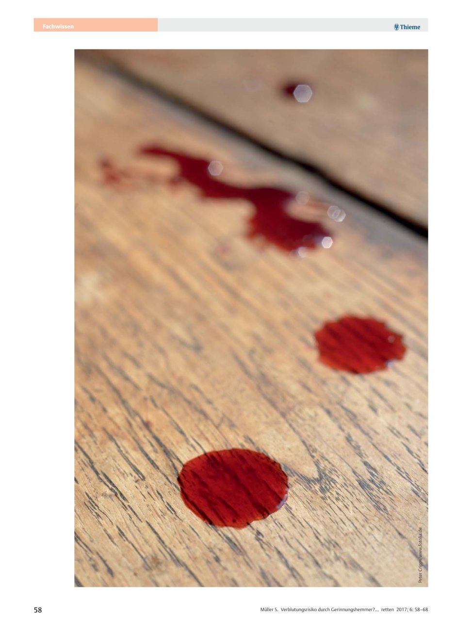 Vorschauseite 1: Verblutungsrisiko durch Gerinnungshemmer?
