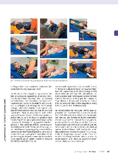 Vorschauseite 3: Infantile Zerebralparese (ICP) mit kombinierter, umschriebener Entwicklungsstörung. Ergotherapeutische Behandlung von Lena (5 Jahre).
