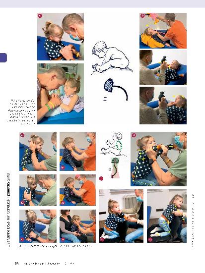 Vorschauseite 4: Infantile Zerebralparese (ICP) mit kombinierter, umschriebener Entwicklungsstörung. Ergotherapeutische Behandlung von Lena (5 Jahre).