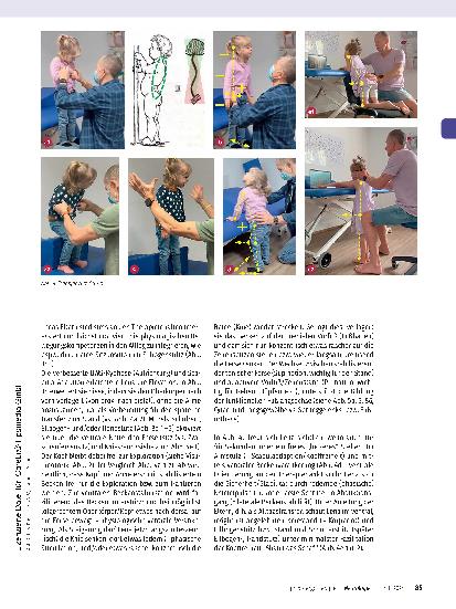 Vorschauseite 5: Infantile Zerebralparese (ICP) mit kombinierter, umschriebener Entwicklungsstörung. Ergotherapeutische Behandlung von Lena (5 Jahre).