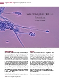 Vorschauseite 1: Schimmelpilze (Teil 4): Fusarium