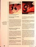 Vorschauseite 5: Die Blutegel in der Schmerztherapie