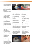 Vorschauseite 2: PFLEGELEXIKON – die Serie zum Sammeln Lokale Unterdrucktherapie – Indikationen, Eigenschaften und Anwendungstipps