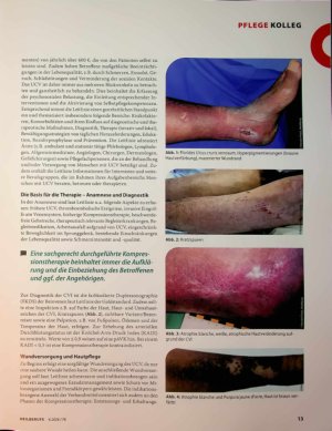 Vorschauseite 2: UCV-Therapie leitliniengerecht und praxisnah