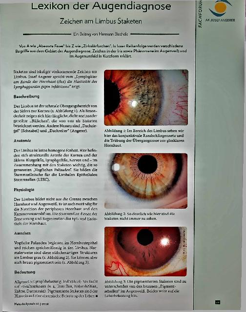 Vorschauseite 1: Lexikon der Augendiagnose: Zeichen am Limbus Staketen