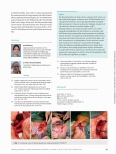 Vorschauseite 4: Karotido-subclavialer Bypass zur Revaskularisation der Arteria subclavia sinistra