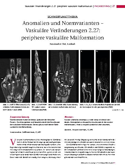 Vorschauseite 1: Anomalien und Normvarianten – Vaskuläre Veränderungen 2. 27: periphere vaskuläre Malformation
