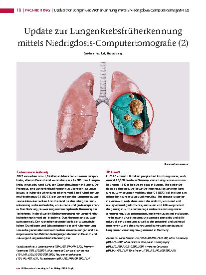 Vorschauseite 1: Update zur Lungenkrebsfrüherkennung mittels Niedrigdosis-Computertomografie (2)