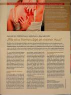 Vorschauseite 1: „Wie eine Nervensäge an meiner Haut" Juckreiz bei mittelschwerer bis schwerer Neurodermitis
