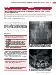 Vorschauseite 2: Anomalien und Normvarianten – Skelettale Veränderungen 3.11 Lumbosakrale Übergangsvariante und Assimilationsgelenk