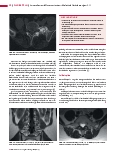 Vorschauseite 3: Anomalien und Normvarianten – Skelettale Veränderungen 3.11 Lumbosakrale Übergangsvariante und Assimilationsgelenk