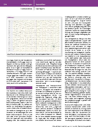 Vorschauseite 4: Postoperatives cerebrales Vasokonstriktionssyndrom nach Implantation eines Ommaya-Reservoirs – Ein Fallbericht