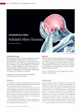 Vorschauseite 1: Schädel-Hirn-Trauma