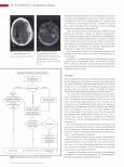 Vorschauseite 5: Schädel-Hirn-Trauma