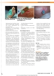 Vorschauseite 2: PFLEGELEXIKON – die Serie zum Sammeln Hydrophobe Wundauflagen – Indikationen, Eigenschaften und Anwendungstipps