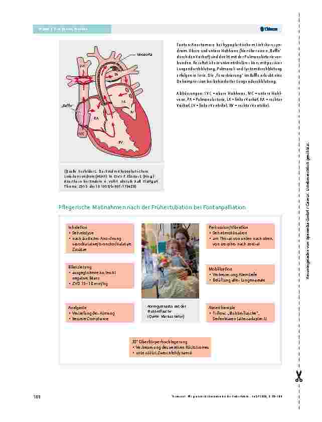Vorschauseite 2: Pflegerische Maßnahmen nach der Frühexkubation bei Fontanpalliation